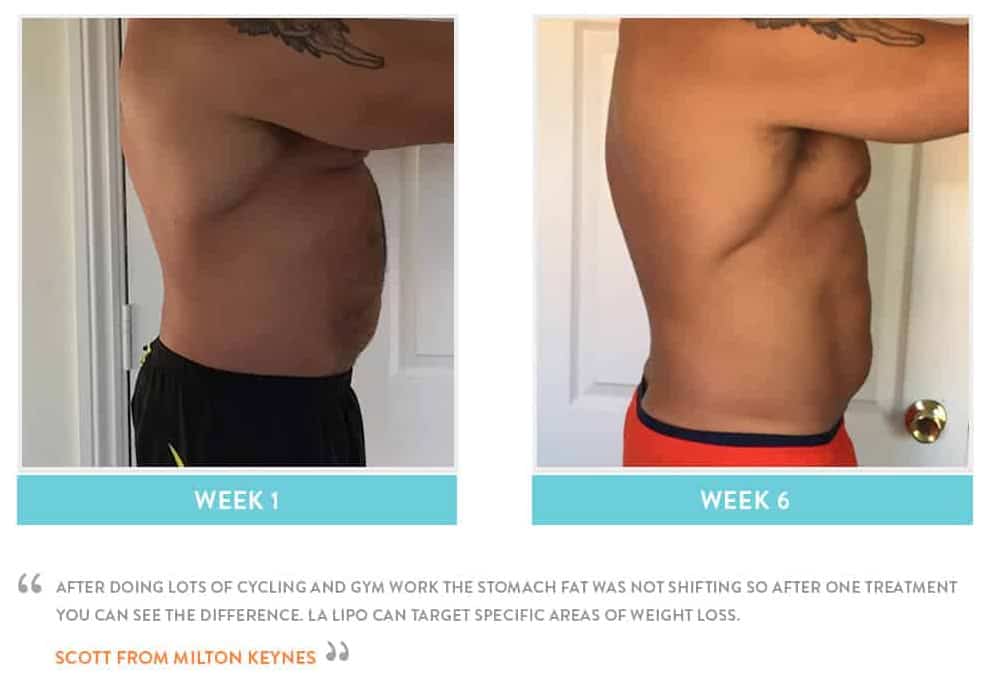 Before & After Stomach Fat Loughborough