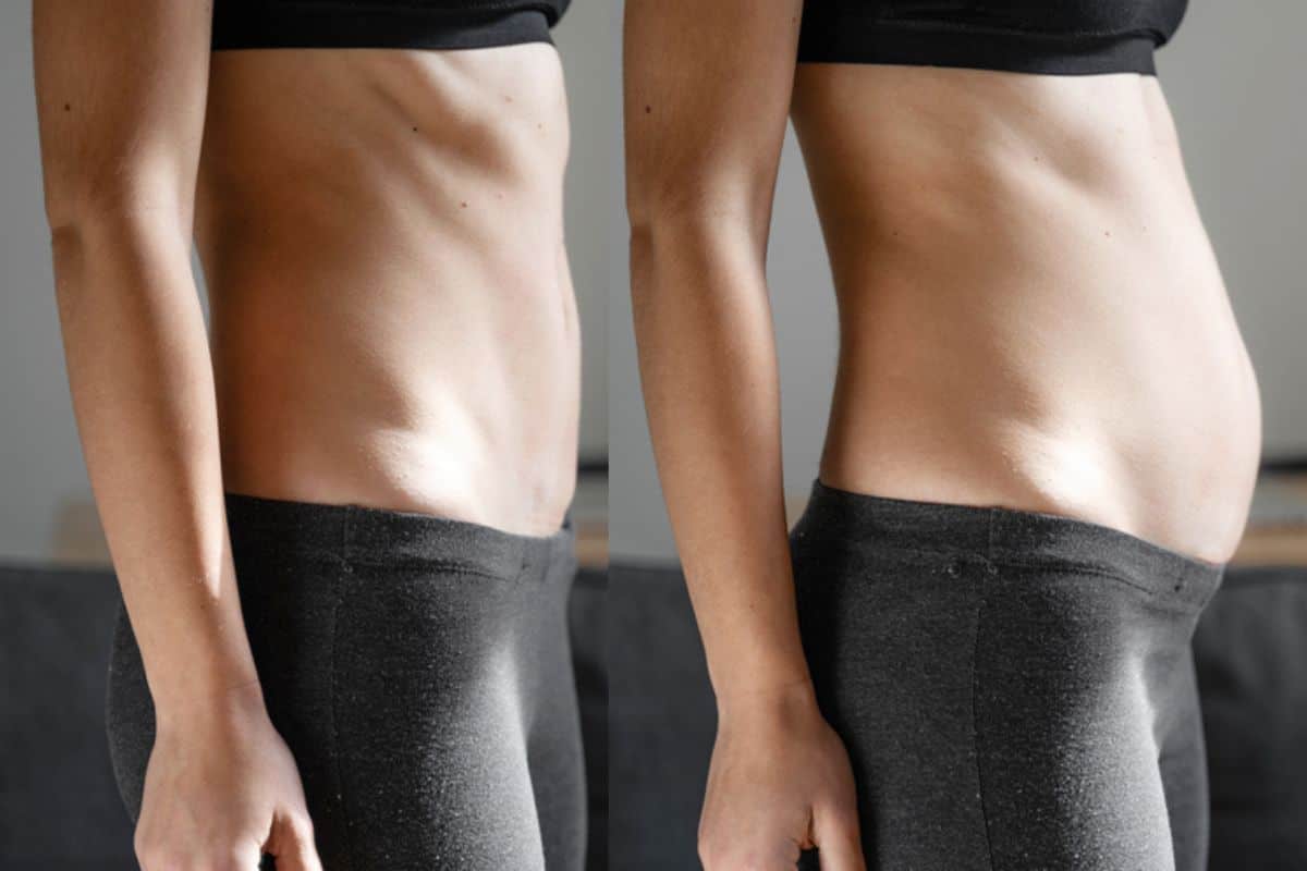 How long does diastasis recti take to improve Loughborough?