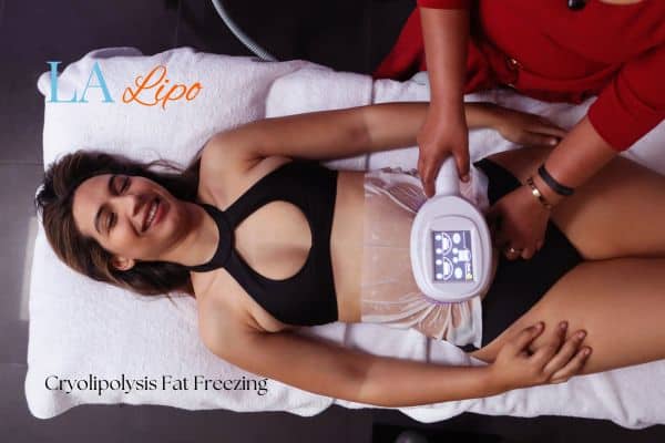 woman getting cryolipolysis Loughborough