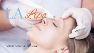 Woman receiving Actinic Keratosis Removal Treatment Loughborough