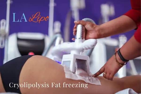 women getting fat freezing Loughborough