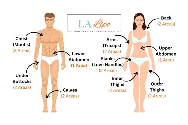 LA LIPO Cryolipolysis Areas Loughborough