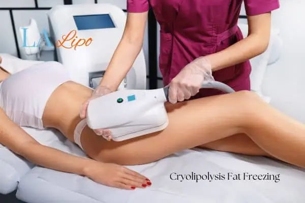 Woman receiving coolsculpting Loughborough treatment on her thighs