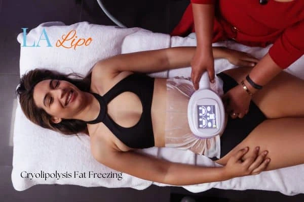 woman getting cryolipolysis Loughborough