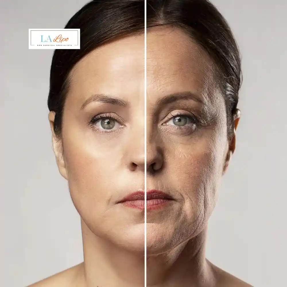 How Can You Tell If Non-Surgical Skin Tightening Is Right for You Loughborough?