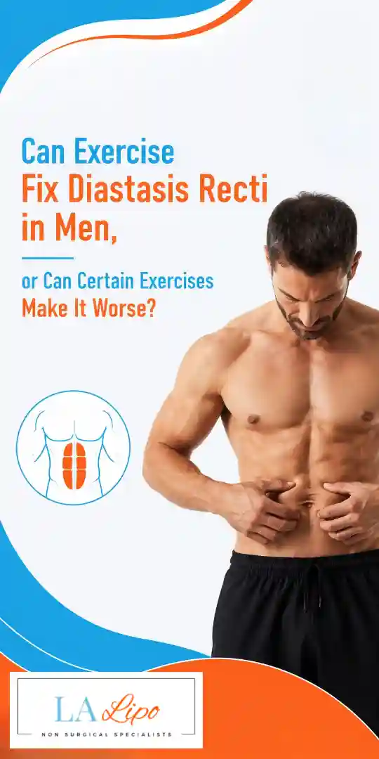 Can Exercise Fix Diastasis Recti in Men, or Can Certain Exercises Make It Worse Loughborough?